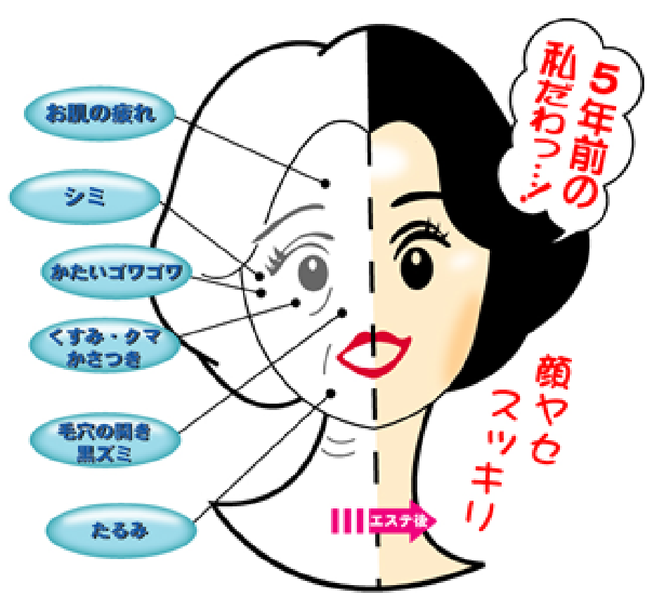 ソニックエステによる効果の説明